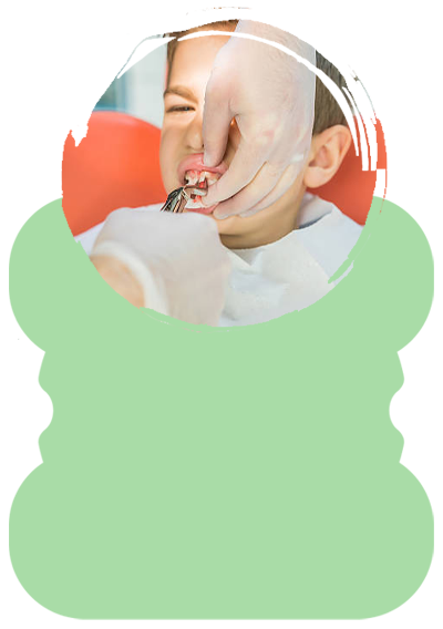 teeth extraction